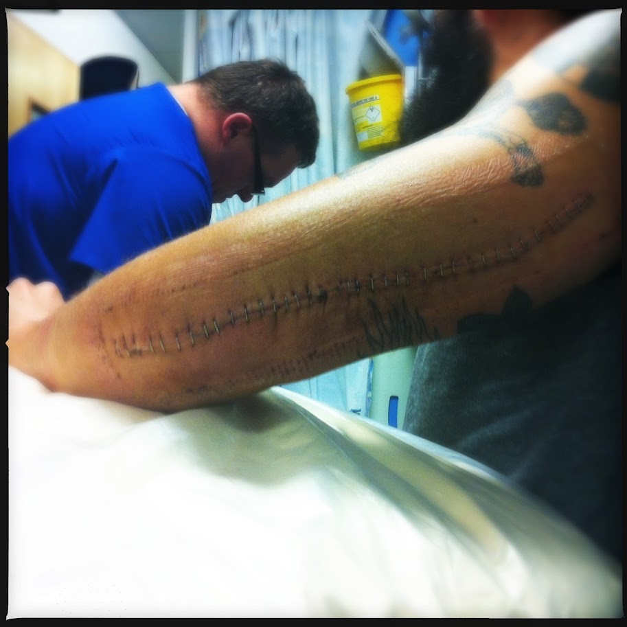 Baroness nach dem schweren Unfall im August 2012