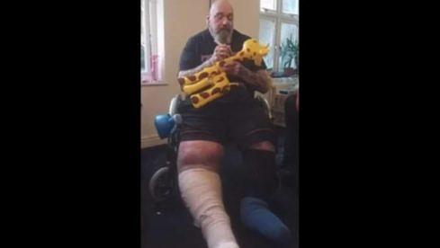 Die Beine von Paul Di'Anno sind krass angeschwollen