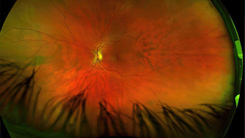 Greg Puciato MIRRORCELL